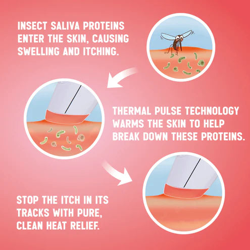 Diagram explaining how insect saliva proteins cause itching and how thermal pulse technology helps relieve it.